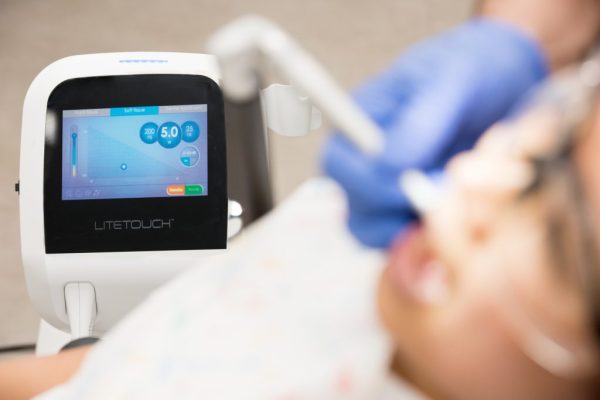 Laser Dentar LiteTouch™ - imagine 3