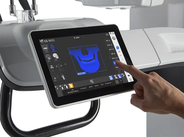 CBCT CS 9600 FOV 16x17 - imagine 2