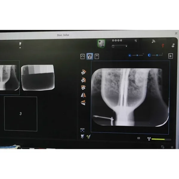 Scanner cu placi fosforice CS 7600 - imagine 4
