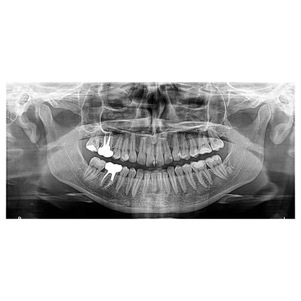 Sistem CBCT CS 8100 3D FOV 8x9 cm - imagine 7