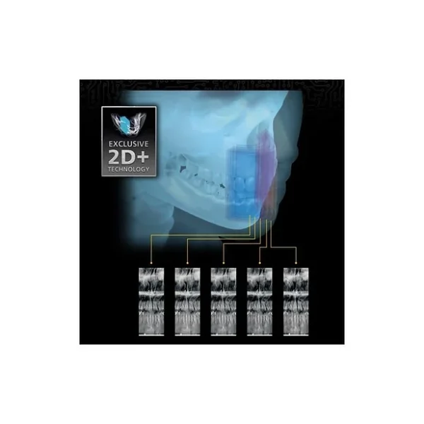 Sistem Panoramic 2D CS 8100 - imagine 2