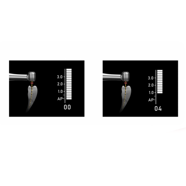 Endomotor Endo Smart Plus-Motor endodontic cu apex locator incorporat - imagine 5