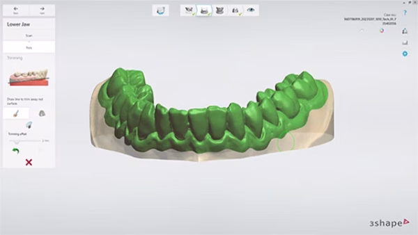 Scanner Laborator 3Shape F8 - imagine 7