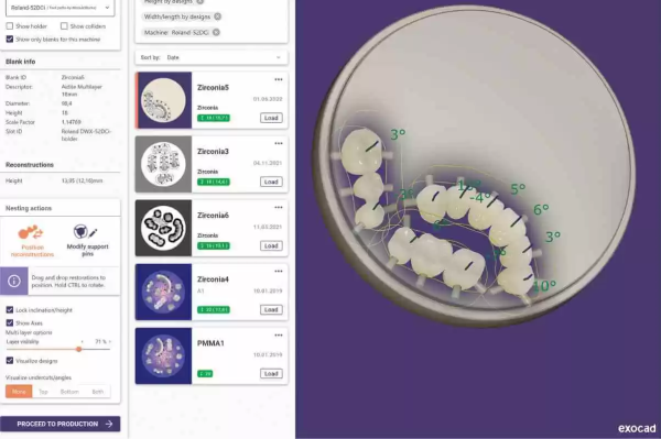 Software CAD Exocad Implant Lab Bundle - imagine 3
