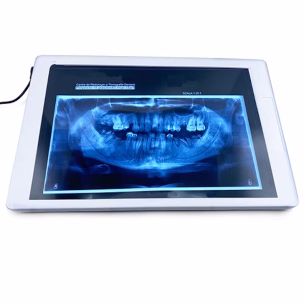 Negatoscop medical 36 x 24 cm,slim - imagine 5
