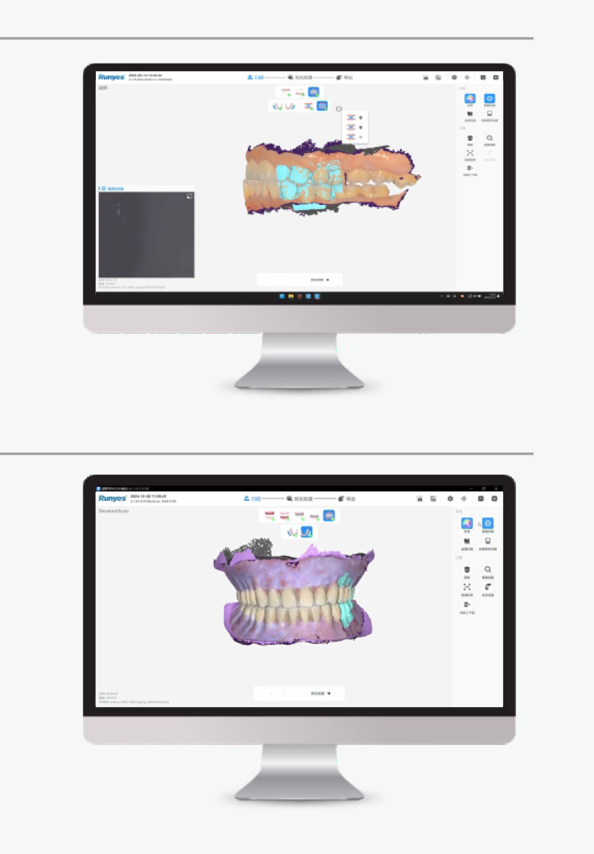 Scanner intraoral wireless 3DS V6 Runyes 9 Scanner intraoral wireless 3DS V6 Runyes - imagine 9