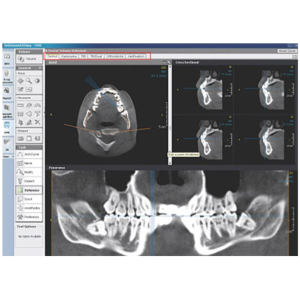 Software OnDemand3D Dental